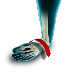 Ankle Instability Surgery