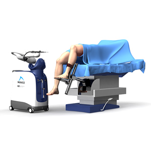 A) Mako robot for total knee arthroplasty. (B) Mako's computer