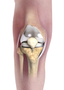 Anatomy of the Hip